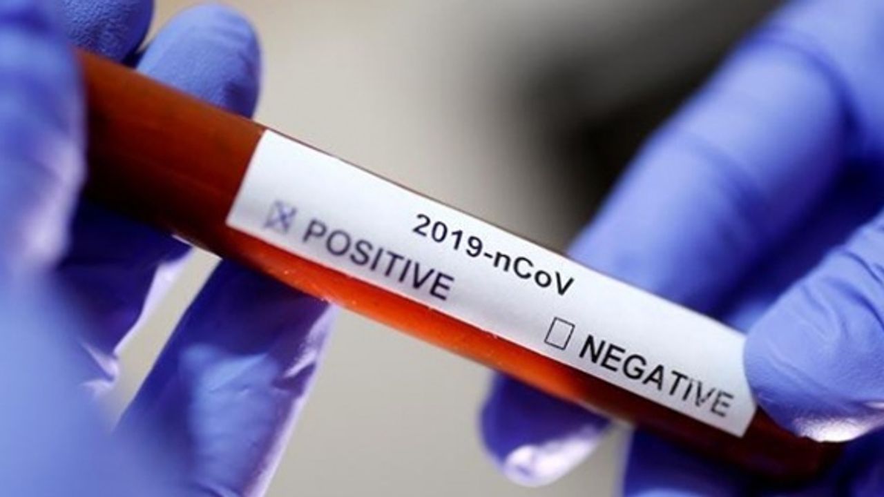 İspanya'da koronavirüs vaka ve ölüm sayısı ikiye katlandı