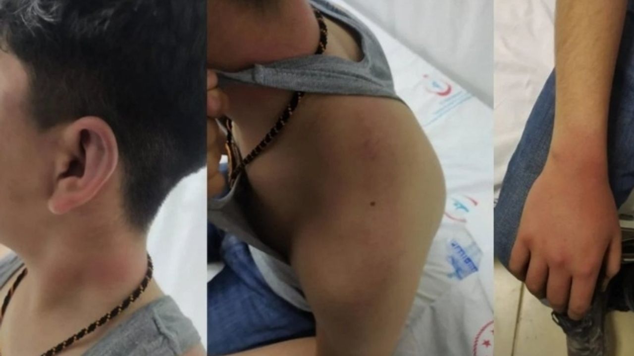 Diyarbakır'da 14 yaşındaki çocuğa şiddet: Tutuklu polis sayısı 5'e yükseldi