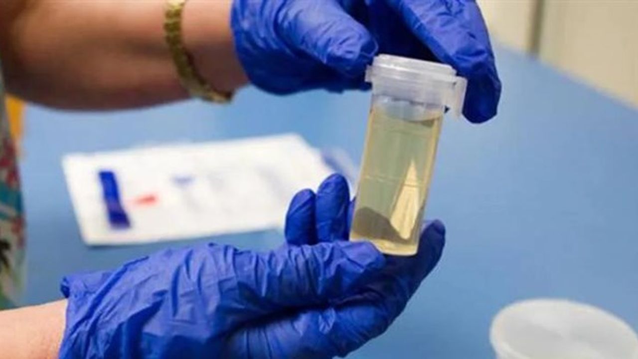 İşe Alımlarda ‘Uyuşturucu Testi’ Dönemi: Kamu Kurumları da Talep Ediyor