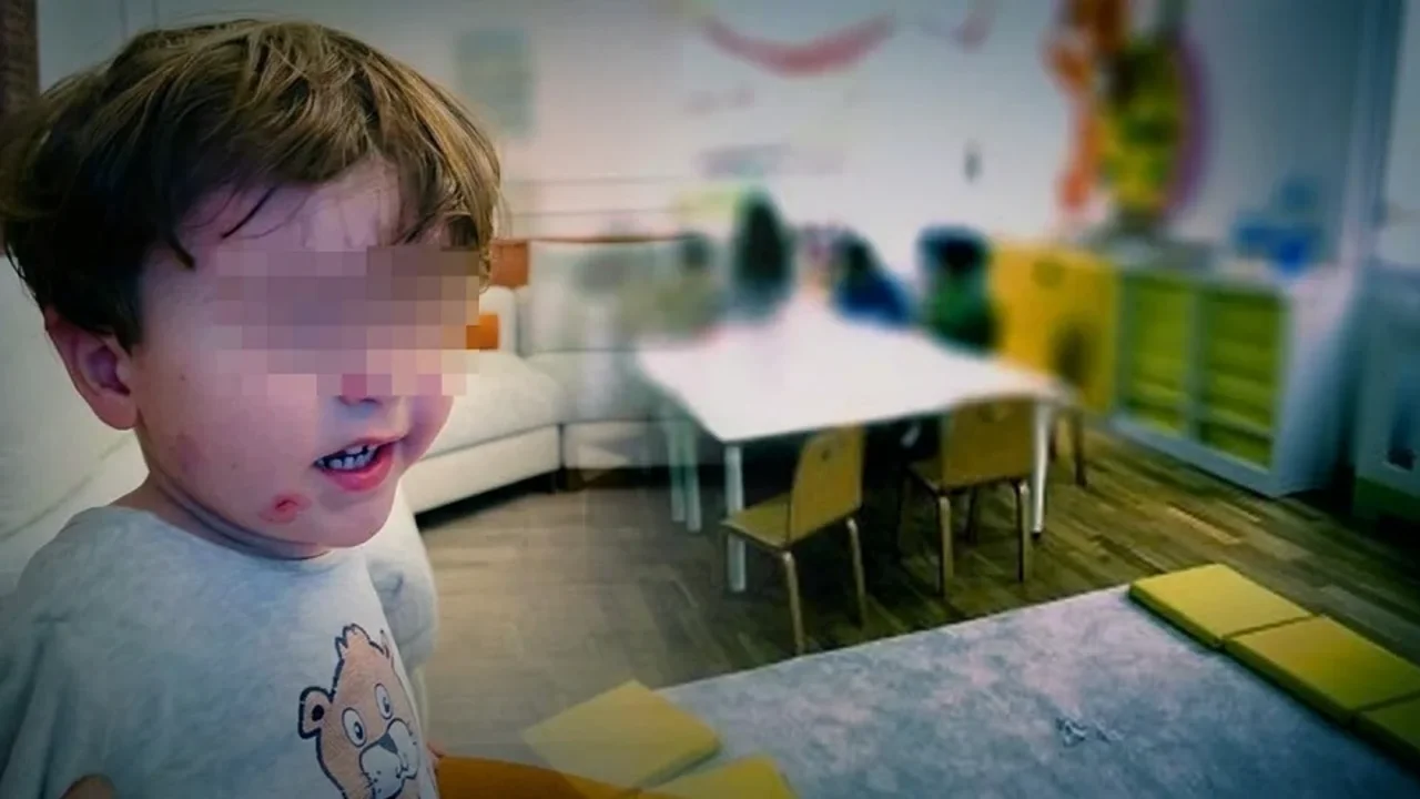 Özel kreşte skandal! 2.5 yaşındaki çocuk darp edildi