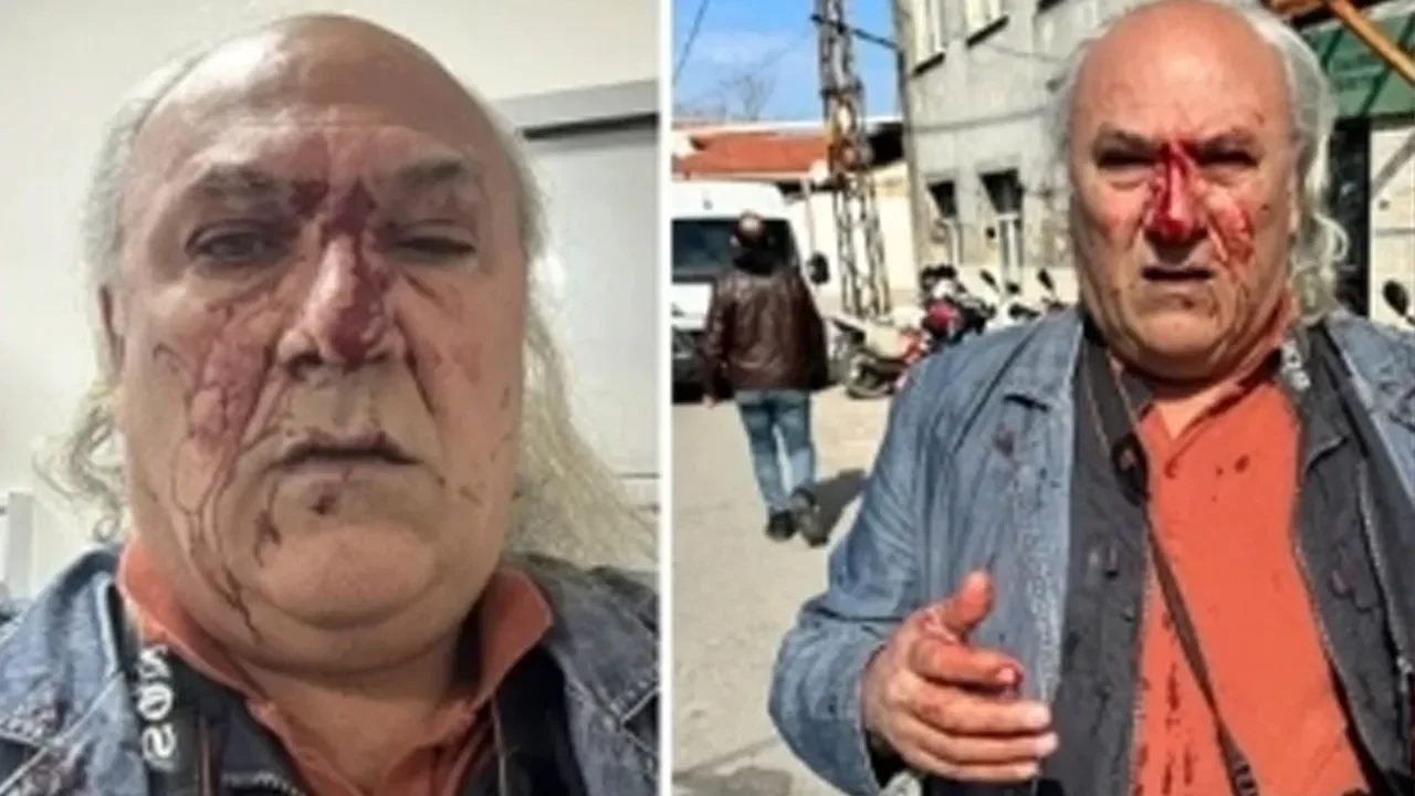 CHP’yi haber yaptı, darbedildi! Gazeteciye sokak ortasında saldırı