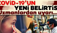 Uzmanlardan coronavirüs uyarısı! Coronavirüste yeni belirti olabilir