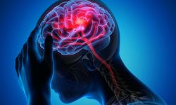 Beyni erken yaşlandırıyor, bu 6 belirtiye dikkat! Alzheimer hastalığı ile...
