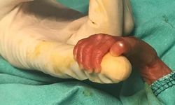 540 gramlık parmak bebeğin mucize yaşamı