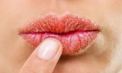 Etkisi dudak dolgusunu aratmıyor dudak dolgunlaştırmak için doğal kürler!