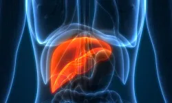 Karaciğer yağlanması nasıl anlaşılır? Karaciğer yağlanmasına hangi besinler iyi gelir?