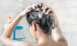 Saç Dökülmesini Önlemek İçin Şampuanınıza Şunları Ekleyin! Saç dökülmesini anında durduran ve uzatan çözüm