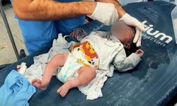 Gazze' de doktorlar anestezi olmadan ameliyat ve amputasyon yapıyor