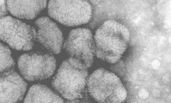 Alaskapox virüsünden dolayı ilk ölüm gerçekleşti