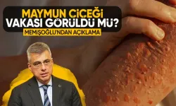 Bakanı Kemal Memişoğlu'ndan maymun çiçeği açıklaması