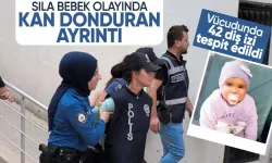 Sıla bebek olayında tüyler ürperten ayrıntı! Vücudunda 42 diş izi tespit edildi