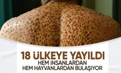 Afrika'da maymun çiçeğinden ölenlerin sayısı bin 100'e yükseldi