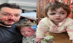 Kucağında bebeği olan babayı darbeden sanık adli kontrolle tahliye edildi