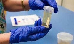 Ankara’daki uyuşturucu soruşturmasında test sonuçları çıktı: 11 kişiden 9’unun örneklerinde madde tespit edildi