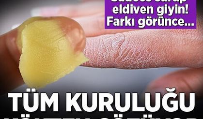 Kuru ve çatlak eller için evde uygulayabileceğiniz 5 doğal çözüm..