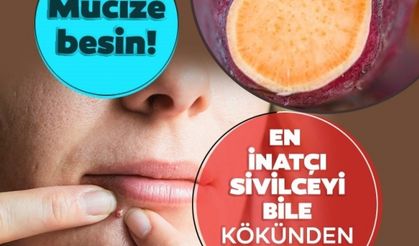 Sivilceleri kökünden kuruttuğu ortaya çıktı! İşte sivilceyi kurutan yiyecekler...