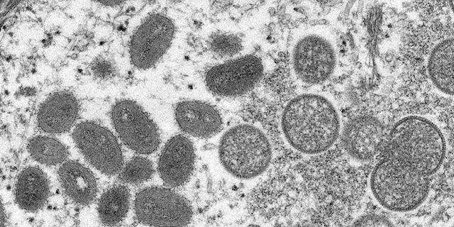 Bilim insanları maymun çiçeği virüsünün kuluçka ve semptom süresini saptadı