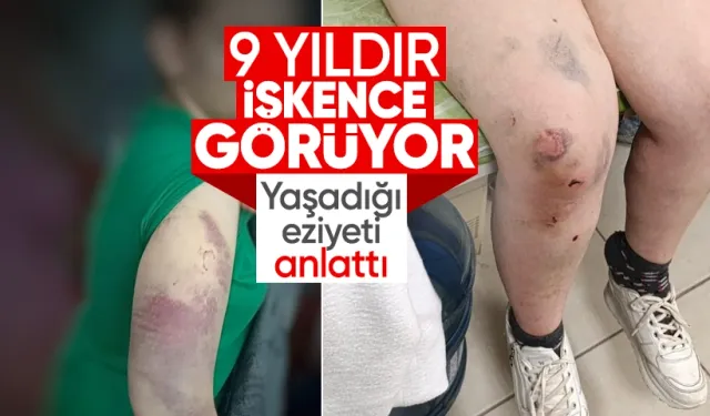 9 Yıldır Karısına Eziyet Uygulayan Koca Tutuklandı: Kadın ve Çocukları Koruma Altına Alındı