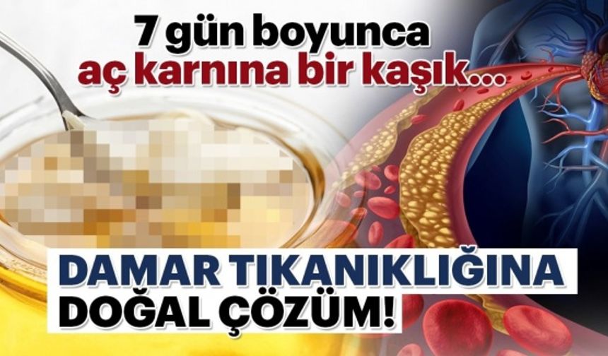 Damar tıkanıklığına doğal çözüm! 7 gün boyunca aç karnına bir kaşık...