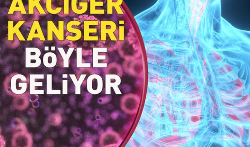 Akciğer kanseri böyle geliyor! İşte o belirtiler