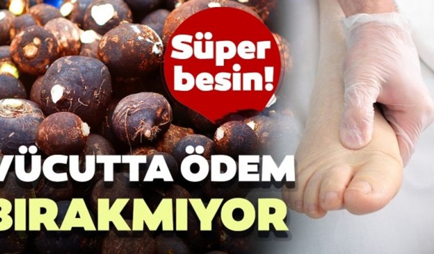 Mucize gıdalar..Vücutta ödem bırakmıyor!