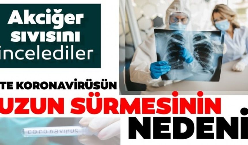 Akciğer sıvısını incelediler: İşte corona virüsün uzun sürmesinin nedeni...