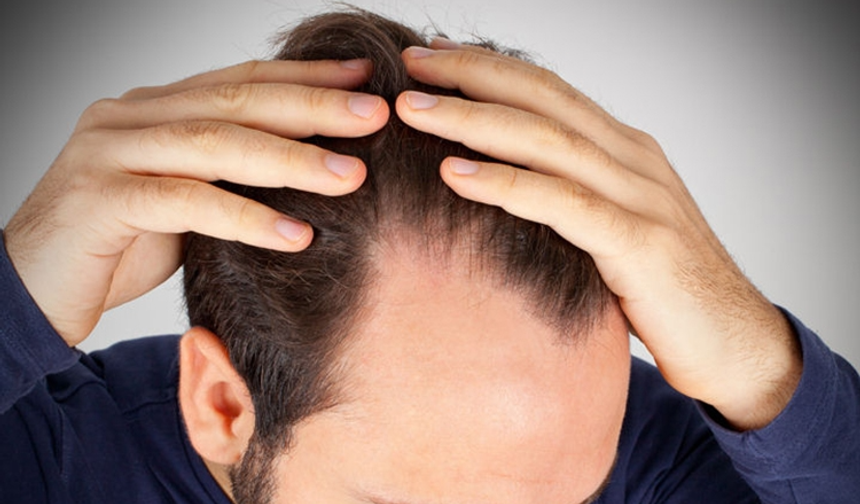 Saç Dökülmesinin Çok Bilinmeyen Sebepleri ve Alınabilecek Etkili Önlemler!