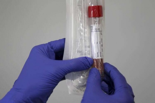 Corona virüs Kovid-19’un insan vücudunda tespit etmek için hastanelerde ve gerekli hallerde ücretsiz gerçekleştirilen PCR testinin bazı özel labaratuvarlarda fahiş fiyata yapıldığı ortaya çıktı. Bağdat Caddesi ve Feneryolu’nda şubesi bulunan iki laboratuvarı aradığımızda Kovid-19 testinin 1200 ve 1250 liraya yapıldığı ortaya