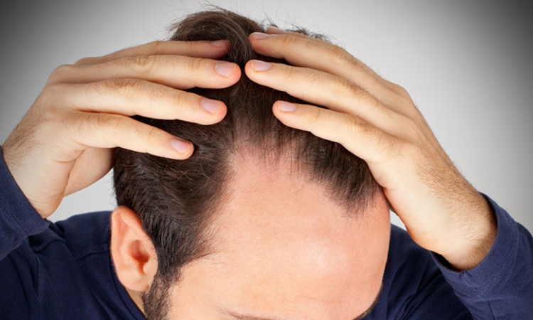 1. Gizli Nedenler: Saçlarınız Neden Dökülüyor?

Stres: Günlük yaşantıdaki stresler saç dökülmesinin en büyük nedenlerinden biridir. Yoğun iş temposu ve şehir hayatının getirdiği stres saç köklerini zayıflatıyor.