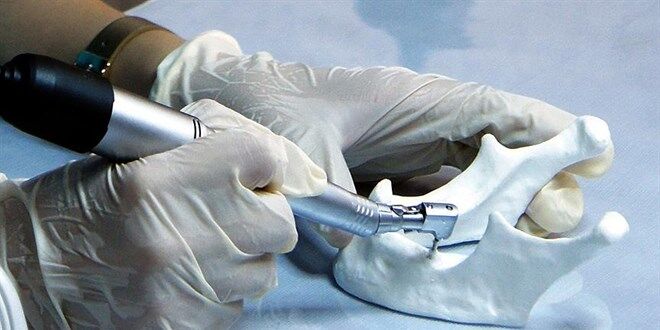 “Alman malı” denilen implant Kore menşeli çıkınca savcılığa başvurdu